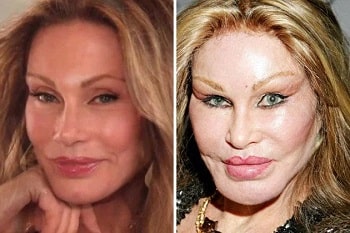 A picture of Jocelyn Wildenstein before (left) and after (right).